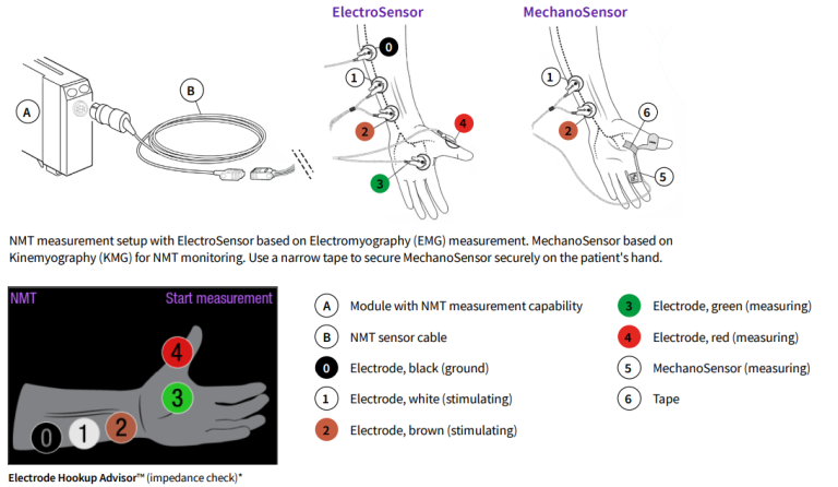 NMT: Helping to Optimize Recovery from Anesthesia | Clinical